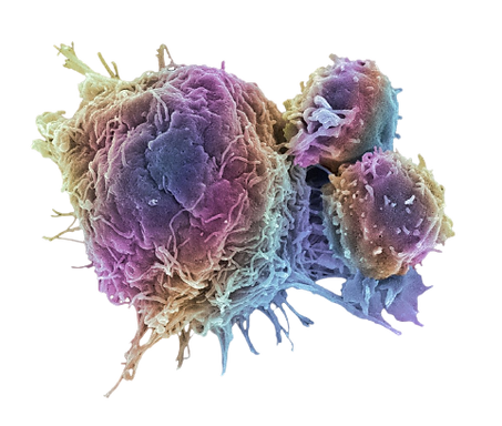 cancer_cell_and_T_lymphocytes-5a28416422fa3a0037111149-removebg-preview.png