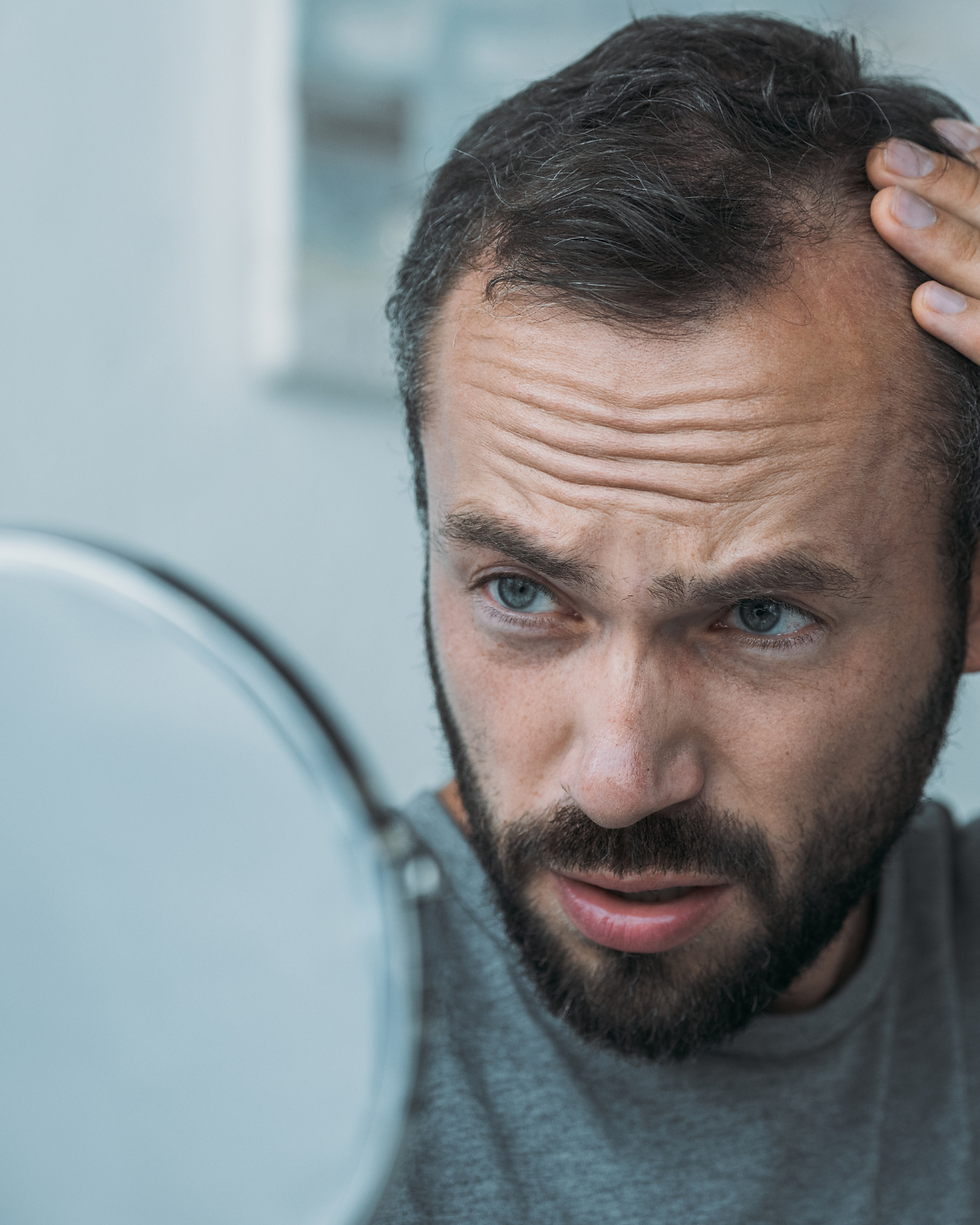 Calvitie et confiance en soi : quand le miroir devient un allié