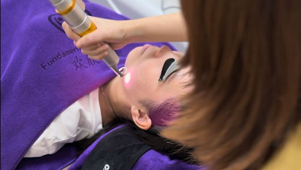 Dr lilin performing pico laser