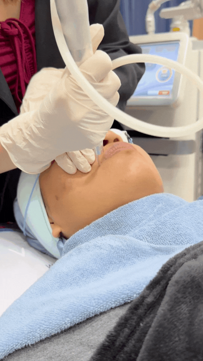 dr lilin performing mole removal
