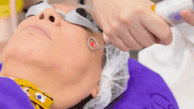Dr lilin performing pico laser on patient