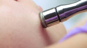 Diamond Microdermabrasion