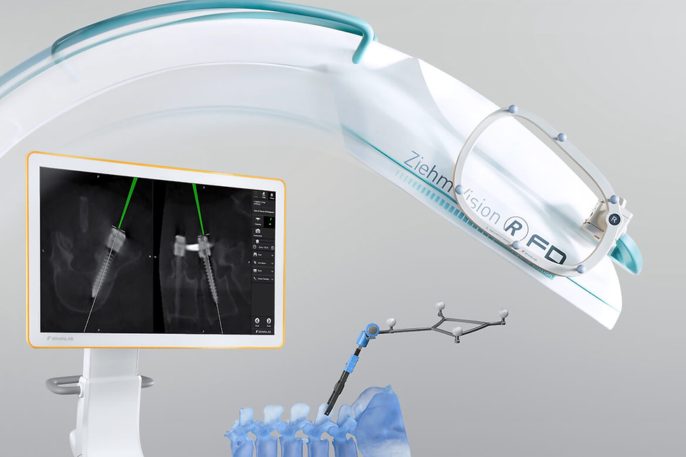 A Tecnologia na Cirurgia de Coluna: Como a Neuro-Navegação Aumenta a Precisão do Procedimento