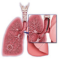 biopsy.jpg