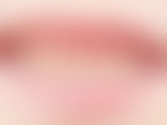 تسوس الرضاعة: خطر صامت يهدد أسنان الأطفال