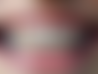 كيف يؤثر التقويم على صحة الفم وجمالية الابتسامة