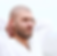 Man with Scalp Micropigmentation