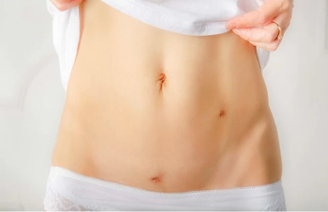 Liposuction scars