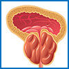 benignprostatehypertrophy.jpg