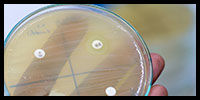 tetracyclineslg.jpg