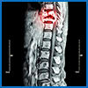 spine.jpg