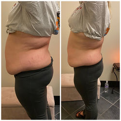 CA6623A0-956D-4218-85C1-2E6CF957F6C3