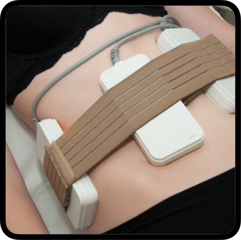 Thumbnail: REFINE Laser Lipo & Ultrasound Cavitation Treatment 