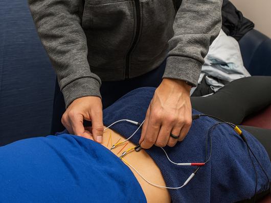 Physical therapist performing dry needling on abdomen.