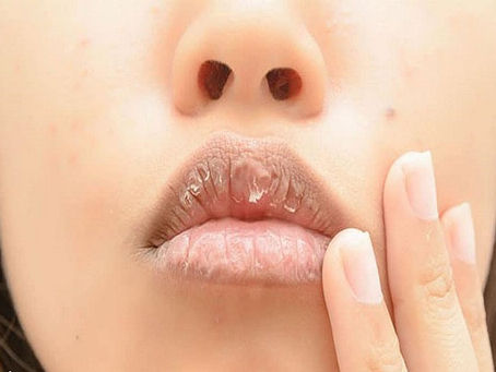 Lợi ích của việc tẩy tế bào chết môi và nên làm bao lâu một lần?