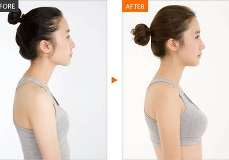 Ăn dứa giúp tăng vòng 1