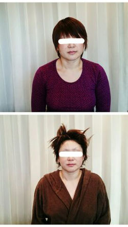 ダイエット肩幅.むくみ.疲れ