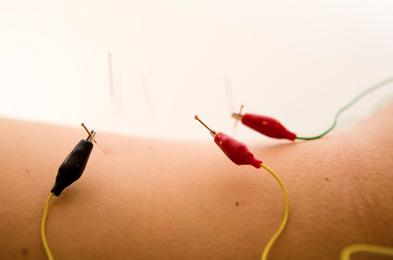 Electrical Stimulation