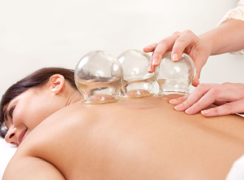 Cupping