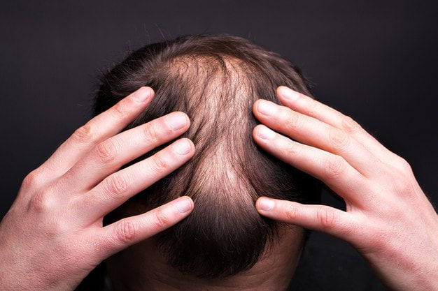 men-with-bald-head-black-wall-close-up-120739-1042_orig
