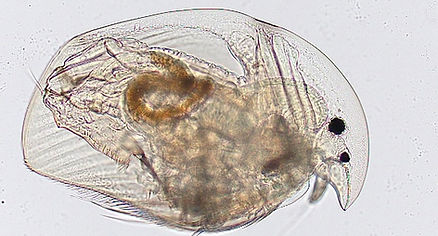 ミジンコちゃん　 Plankton Gallery | 大竹裕里恵（Otake.Y）