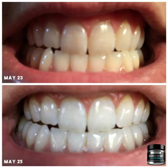 Rawhonest Teeth Whitening - Activated Charcoal Powder With Coconut, Xylitol, and Peppermint - 100% Natural & Effective, Removes Stains & Promotes Oral Hygiene, Made in USA.