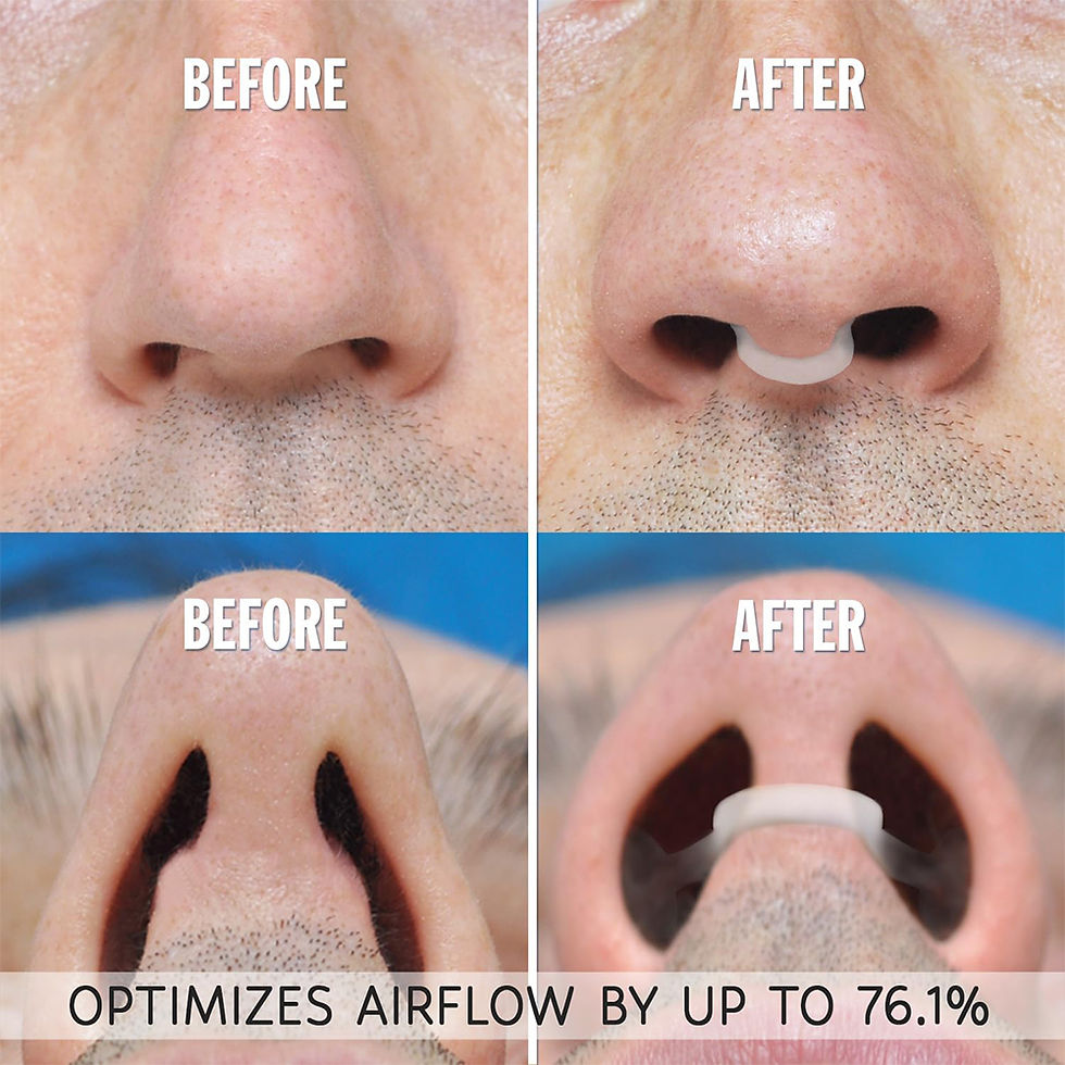 Miniatura: Clip Nasal AuraVibes de Silicone Antirronco — Respirador Nasal