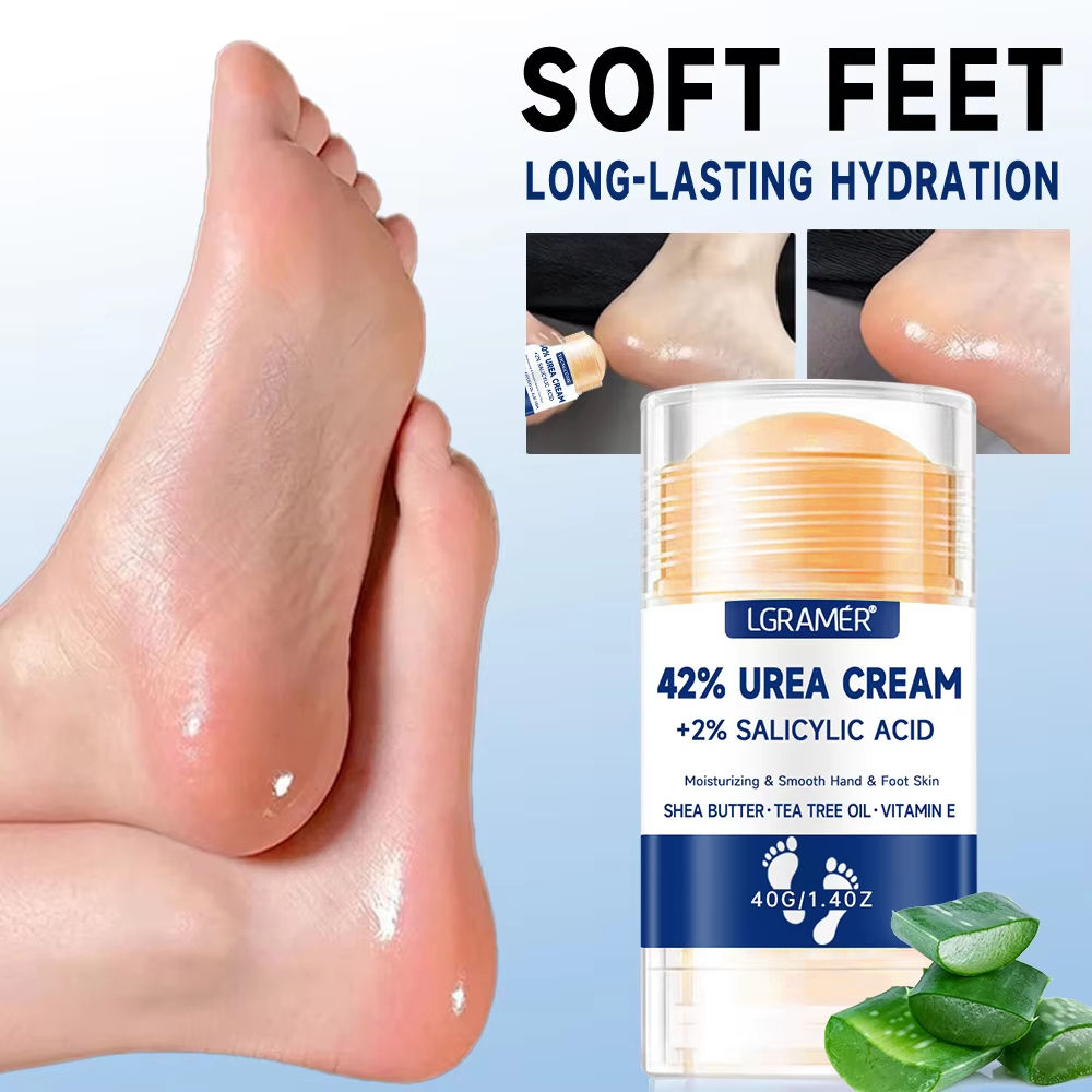 Creme para os Pés com 42% de Ureia + 2% de Ácido Salicílico – Hidratação