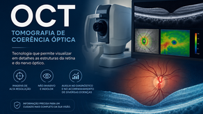 OCT (Tomografia de Coerência Óptica): um exame que permite analisar o nervo óptico e a retina em detalhes