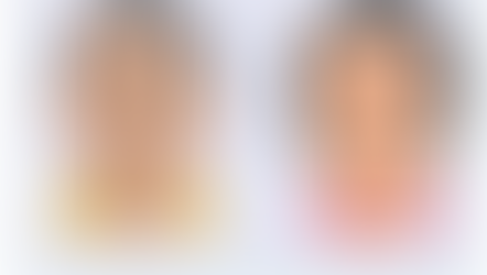 Paralisia Facial e os Olhos: O Que Você Precisa Saber ?