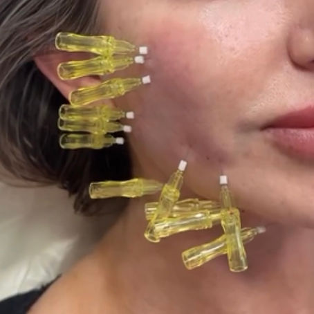 PDO Mono Threads: How Many Do You Really Need?