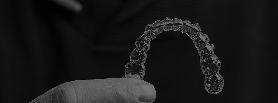 cleaning-aligners-blog-header_edited.jpg