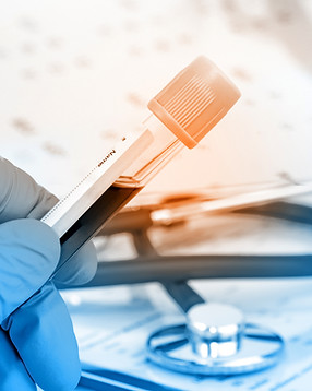 Blood Test