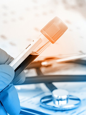 Blood Test