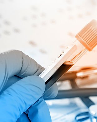 Blood Test