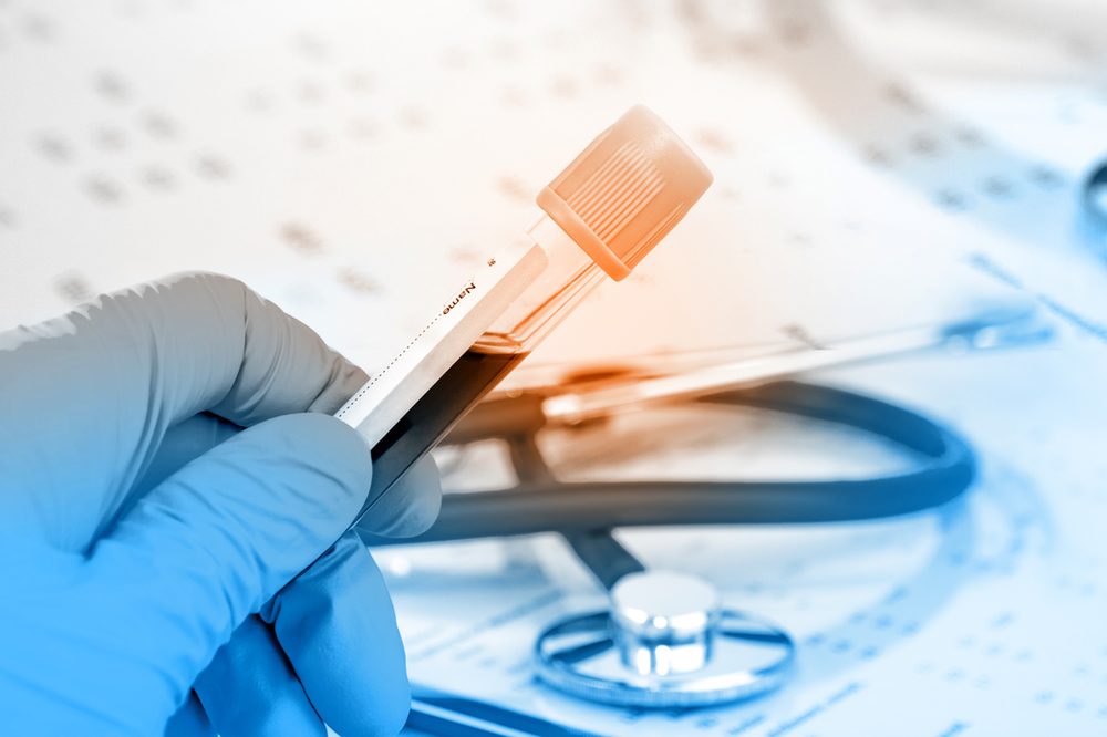 AMH Blood Test amh-blood-test