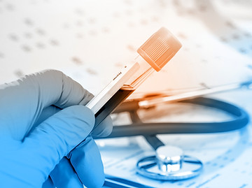 Blood Test