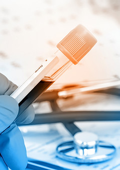 Blood Sample Analysis