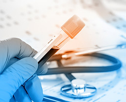 Blood Test