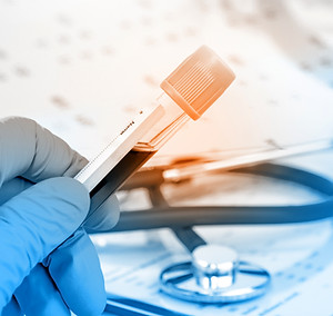 Blood Test