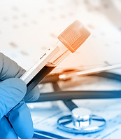 Blood Sample Analysis