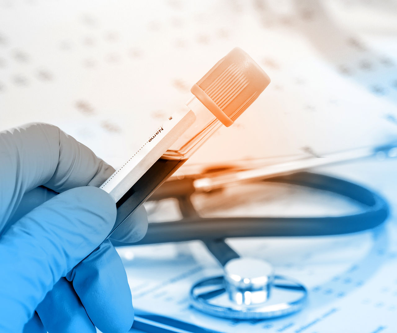 Prueba de sangre