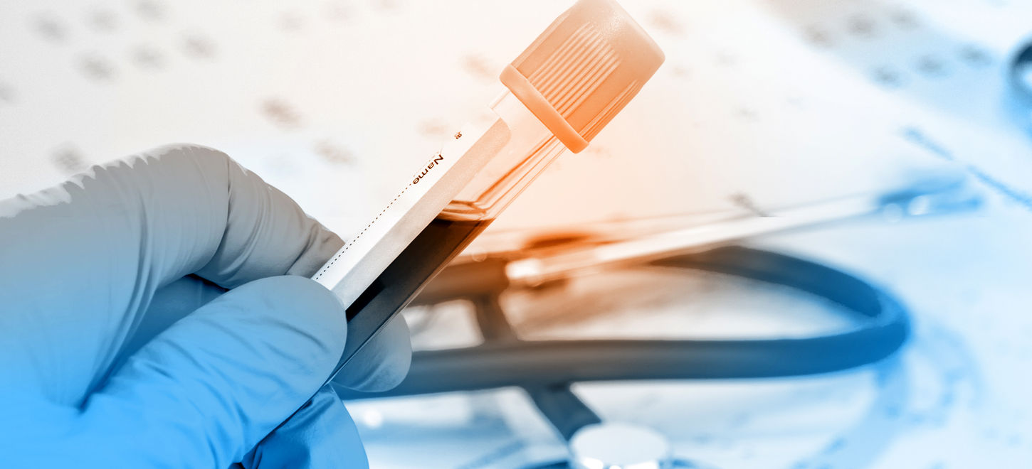 Blood Test