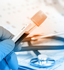 Prueba de sangre