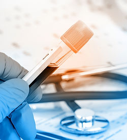 Blood Test
