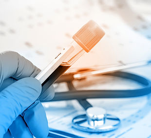 Blood sample testing equipment