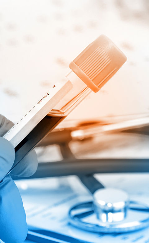 Blood Test
