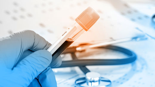 Health Care Insurance Reform. An Expert's Opinion. Why it is so difficult in the USA. Too many stakeholders/ middle men