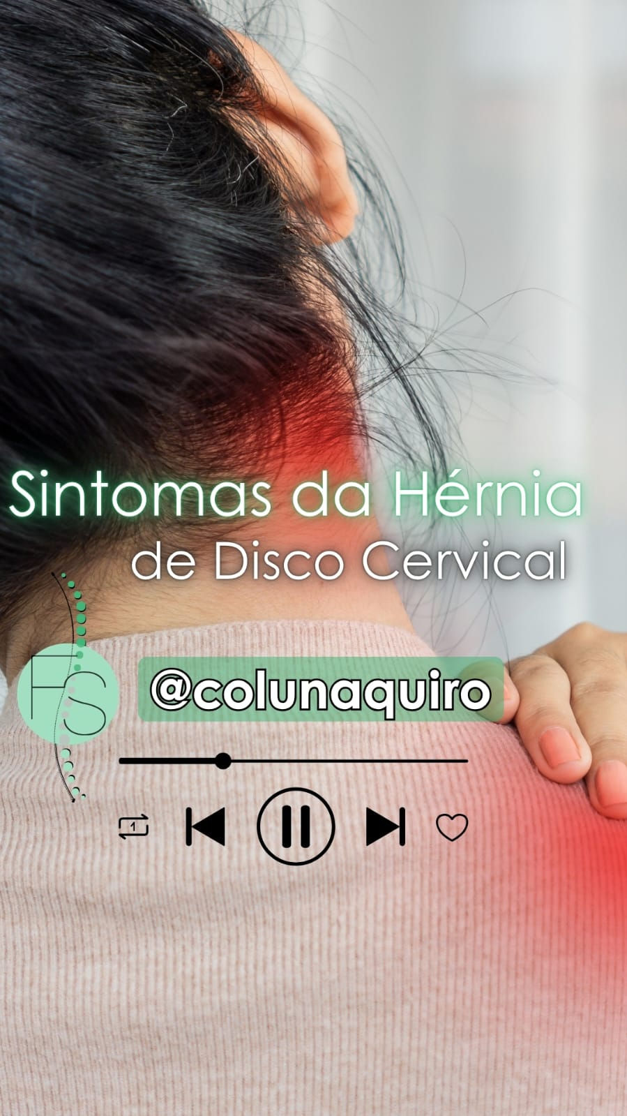 Sintomas da Hérnia de Disco Cervical