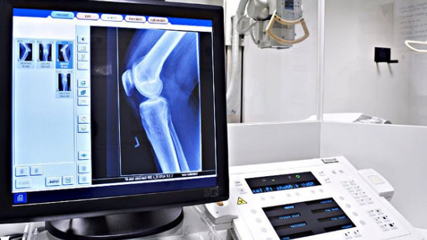 radiologia-700x438.jpg